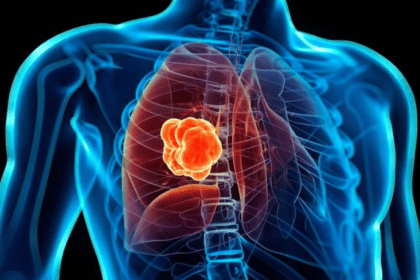 divarasib-cancer-pulmon-kras
