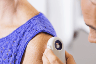 FDA mantiene dudas sobre terapia de Replimune