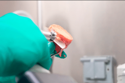 “Hueso molido INS benefició a 75 pacientes en Costa Rica 2025”