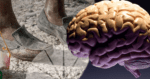 ¿La pobreza cambia el cerebro?