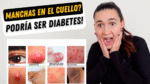 Señales de diabetes visibles en el rostro humano