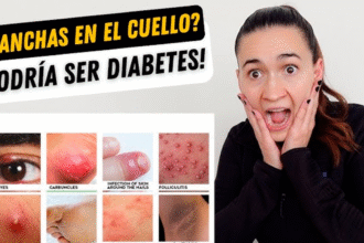 Señales de diabetes visibles en el rostro humano