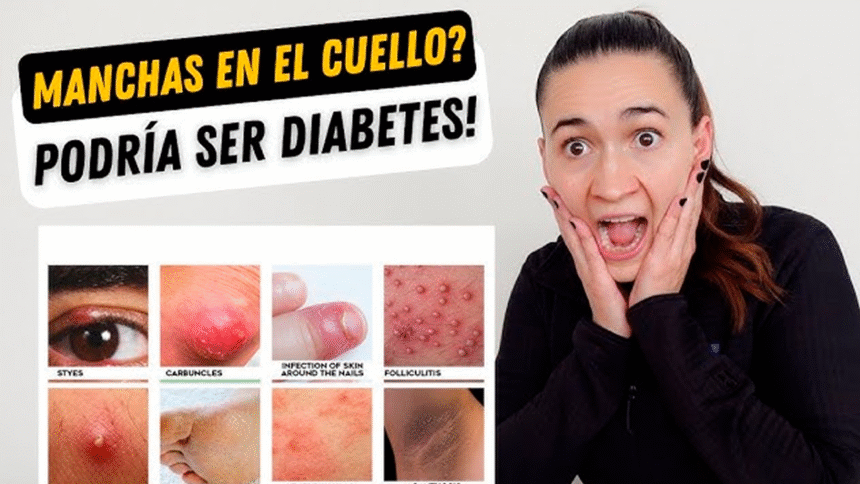 Señales de diabetes visibles en el rostro humano