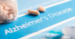 Adiós a la agresividad en Alzheimer