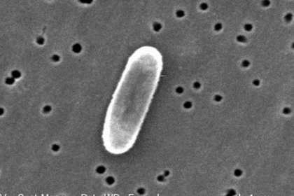 Bacteria Ralstonia mannitolilytica en hospitales de Costa Rica