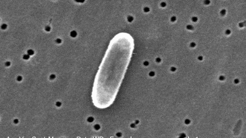 Bacteria Ralstonia mannitolilytica en hospitales de Costa Rica