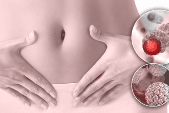 El impacto del virus del papiloma: Así busca el Ministerio de Salud salvar a más de 138 mujeres al año