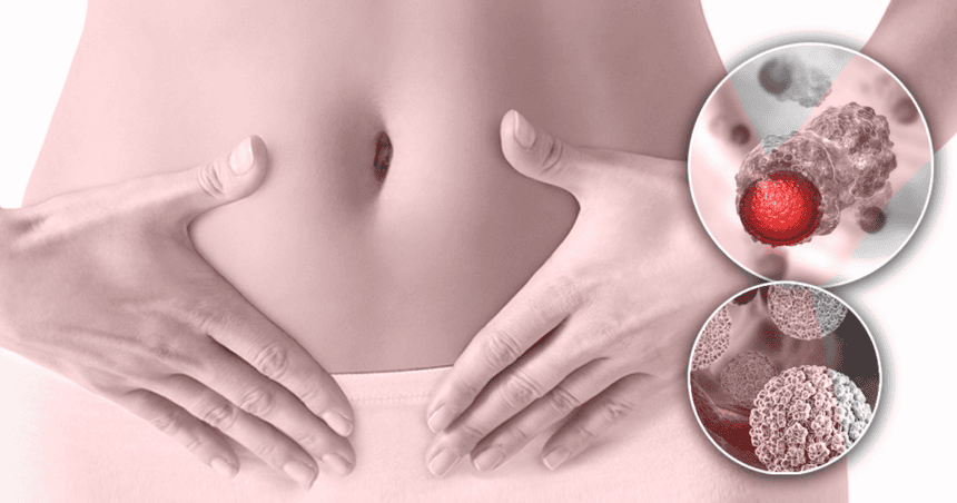 El impacto del virus del papiloma: Así busca el Ministerio de Salud salvar a más de 138 mujeres al año