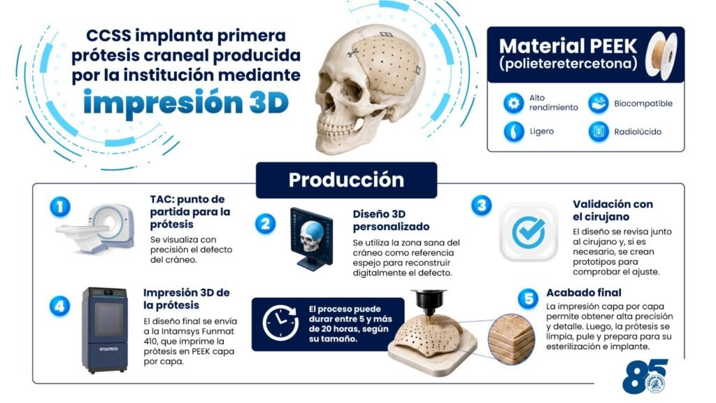 Prótesis